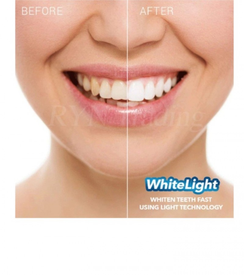 White Light Teeth Whitening System - Blue